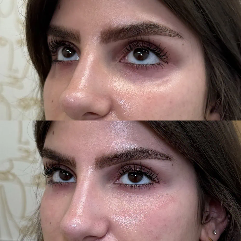 a woman with long brown hair, biostimulators-ar-aesthetics-in-melbourne-fl-three