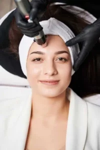 RF Microneedling Treatment in Melbourne & Tampa, FL by AR Aesthetics PLLC