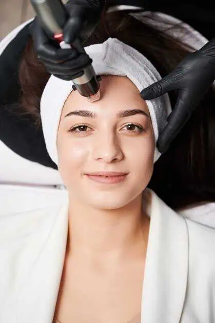 RF Microneedling Treatment in Melbourne & Tampa, FL by AR Aesthetics PLLC