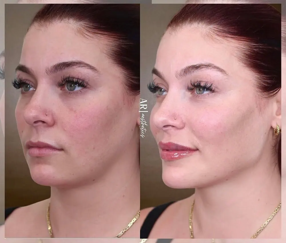 Facial Balancing Services in Ar Aesthetics Two