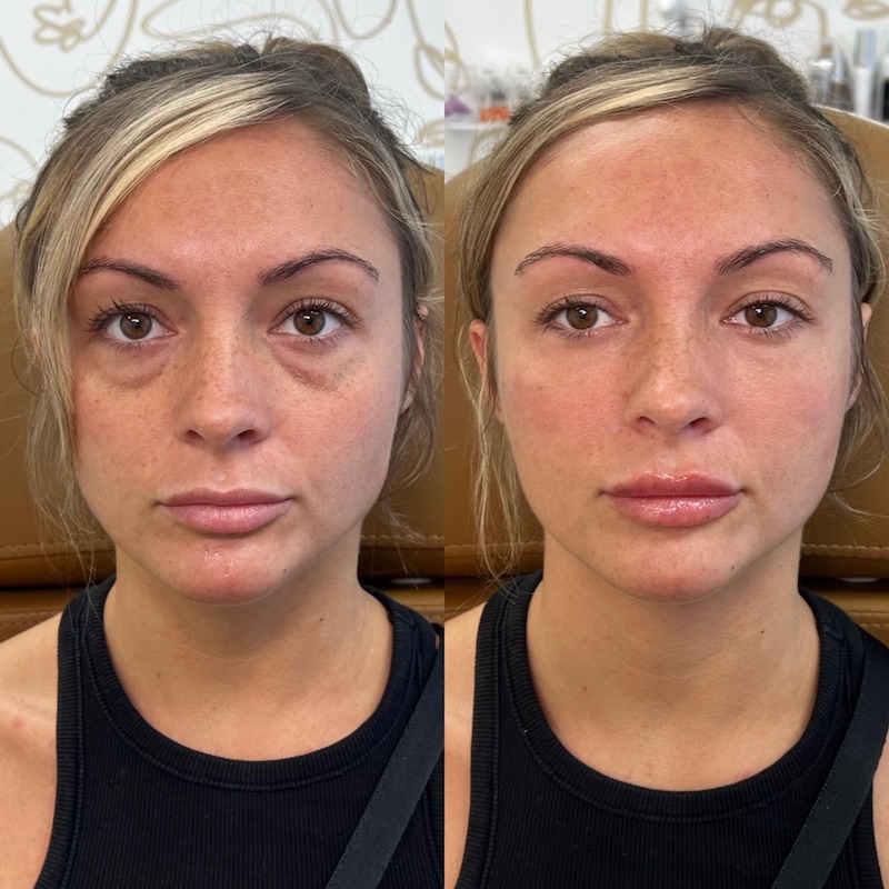 Facetune_10-03-2023-12-43-05