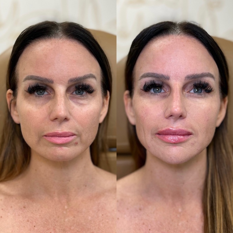 Facetune_16-03-2023-12-11-30