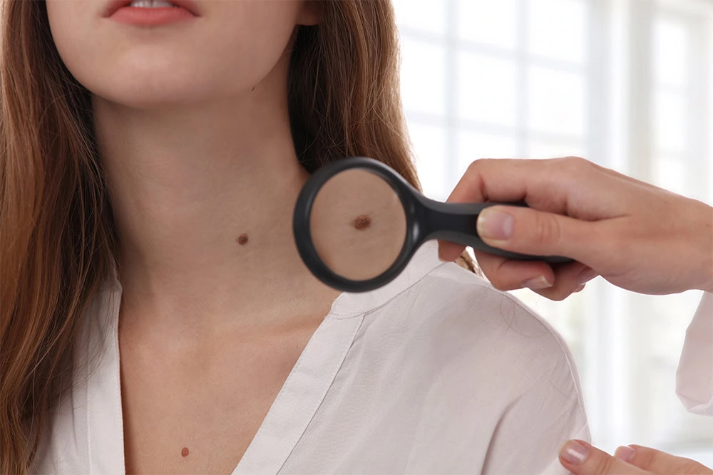 a person looking at a mole on a woman's neck